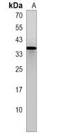 Anti-MND1 Antibody