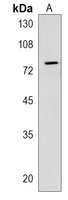 Anti-CRTAC1 Antibody