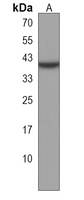 Anti-ZNF589 Antibody