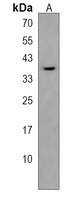 Anti-PDLIM4 Antibody