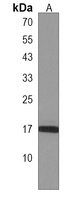 Anti-SYS1 Antibody