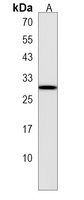 Anti-STXBP6 Antibody
