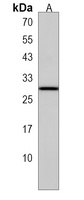 Anti-CGB2 Antibody