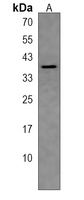 Anti-DHRS1 Antibody