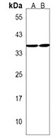 Anti-RQCD1 Antibody