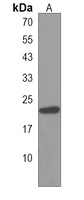 Anti-HOXB6 Antibody