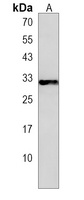 Anti-CELA1 Antibody