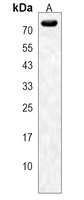 Anti-SLFN12 Antibody