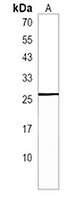 Anti-NXNL1 Antibody