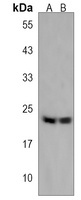 Anti-LZIC Antibody