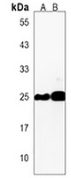 Anti-HMGB4 Antibody