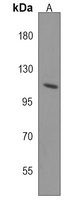 Anti-PHF20L1 Antibody