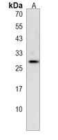 Anti-CLEC9A Antibody