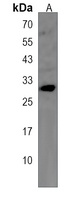 Anti-CRISP1 Antibody