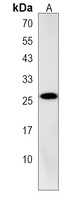 Anti-AIDA Antibody