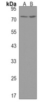 Anti-CCIN Antibody