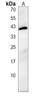 Anti-SNX21 Antibody