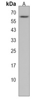 Anti-PGM5 Antibody