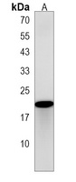 Anti-DNAJC5G Antibody