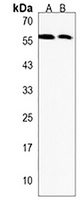 Anti-CRLF3 Antibody