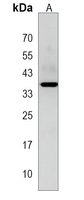 Anti-PBLD Antibody