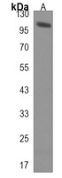 Anti-HECTD3 Antibody