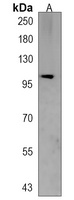 Anti-ARID5B Antibody