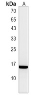 Anti-EMP1 Antibody