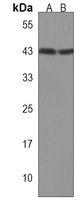 Anti-AADACL2 Antibody