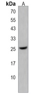 Anti-HMGN5 Antibody