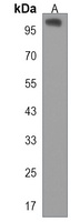 Anti-AGAP3 Antibody