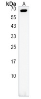 Anti-LCORL Antibody