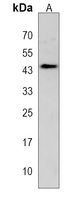 Anti-IER5 Antibody