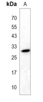 Anti-EPDR1 Antibody