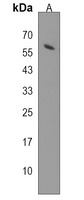 Anti-NELFCD Antibody