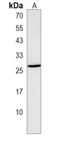 Anti-TRAT1 Antibody