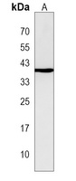 Anti-GFOD2 Antibody