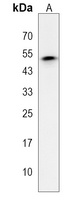 Anti-P2Y6 Antibody