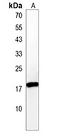 Anti-PPIL3 Antibody