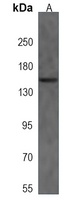 Anti-NCAPG2 Antibody