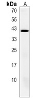 Anti-RGS11 Antibody
