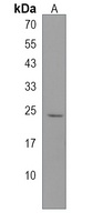 Anti-ANP32B Antibody