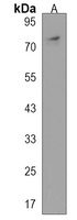 Anti-PHEX Antibody