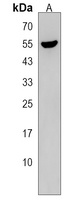 Anti-TTC8 Antibody