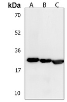 Anti-LY6G6F Antibody
