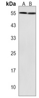 Anti-XKRX Antibody