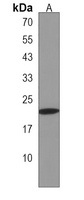 Anti-H2BFWT Antibody