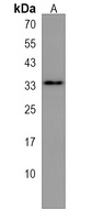 Anti-SULT1B1 Antibody