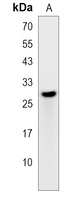 Anti-PCTP Antibody