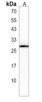 Anti-SYNGR2 Antibody